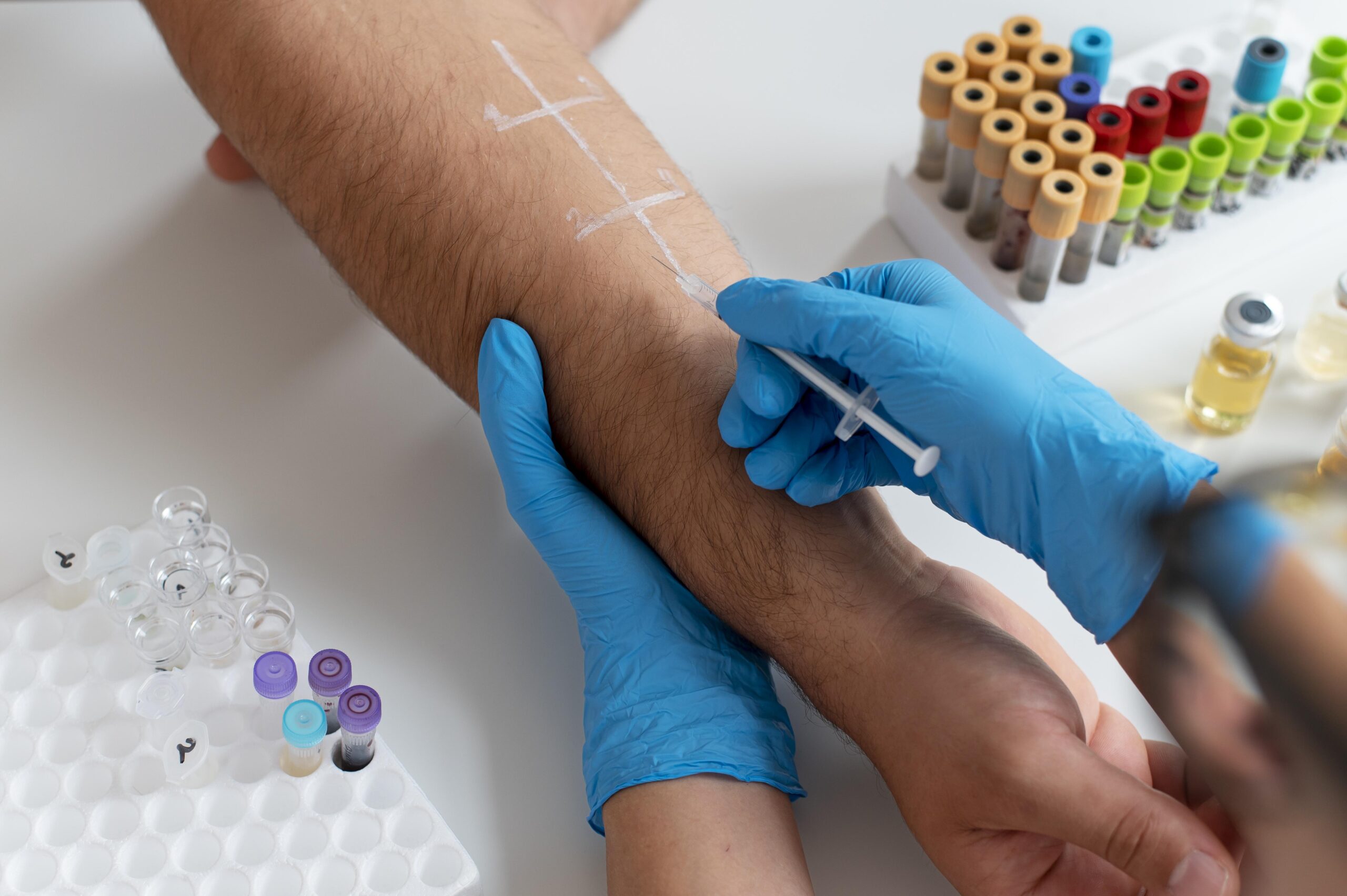 Types of Allergy test